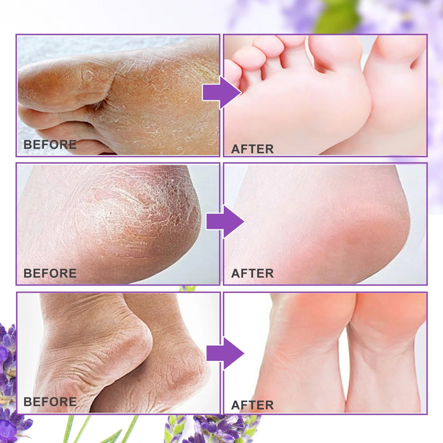 Foot Peeling Mask